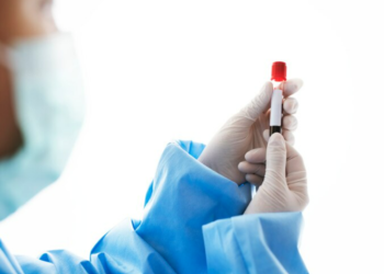 El Centro Regional de Hemoterapia llama a donantes de sangre A+